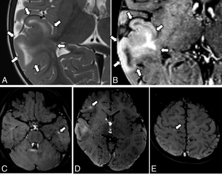 FIG 6.