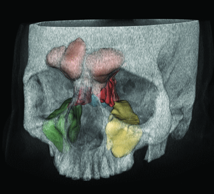 FIG 1.