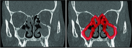 FIG 2.