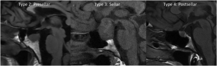 FIG 1.
