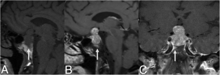 FIG 6.