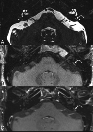 FIG 1.