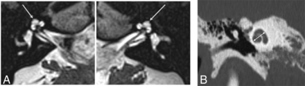 FIG 1.