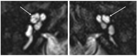 FIG 2.