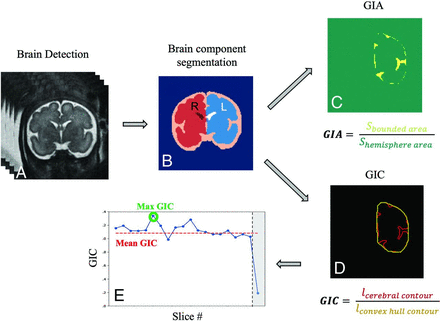 FIG 1.