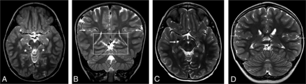 FIG 6.
