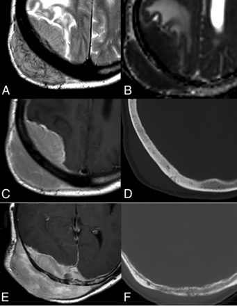 FIG 6.
