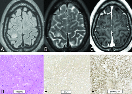 FIG 1.