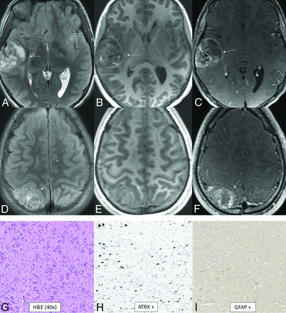 FIG 4.