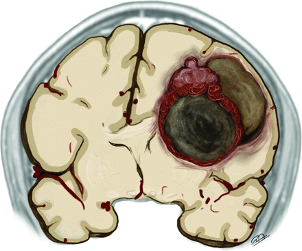 FIG 4.