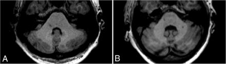 FIG 1.