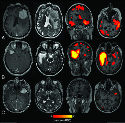 FIG 2.