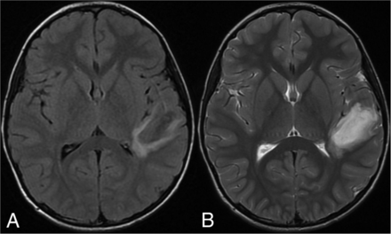 FIG 3.