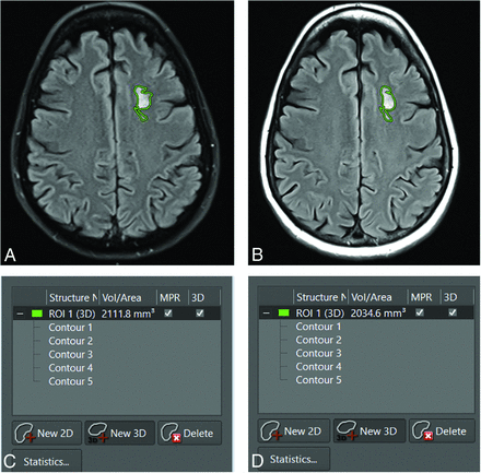 FIG 3.