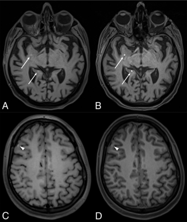 FIG 2.