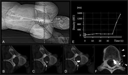 FIG 1.