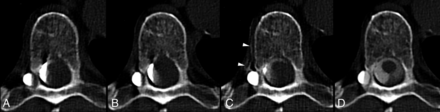 FIG 2.