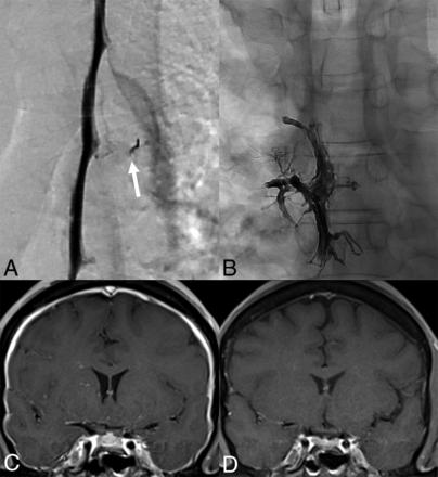 FIG 4.