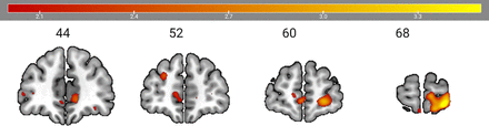 FIG 4.