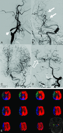 FIG 2.