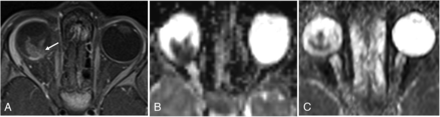 FIG 4.