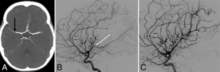 FIG 2.