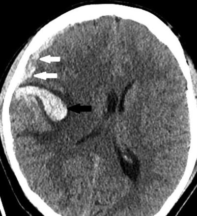 FIG 1.
