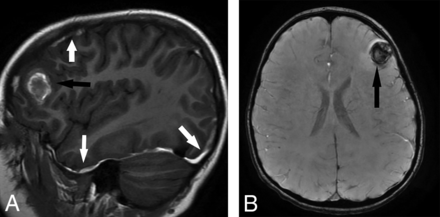 FIG 4.