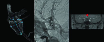 FIG 5.