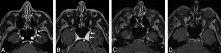 FIG 6.