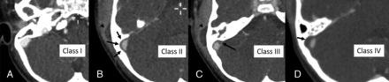 FIG 1.