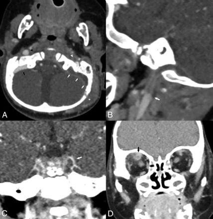 FIG 3.