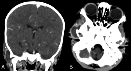 FIG 5.