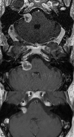 FIG 1.