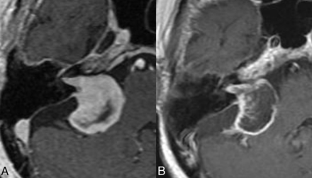 FIG 2.