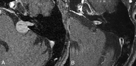 FIG 3.