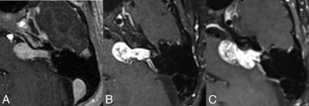 FIG 5.