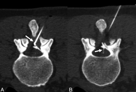 FIG 2.
