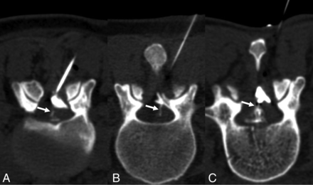 FIG 3.