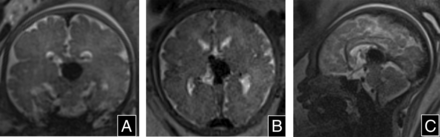 FIG 1.