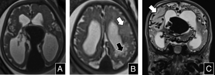FIG 2.