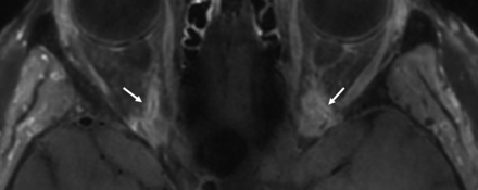 FIG 9.