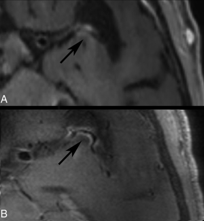 FIG 1.