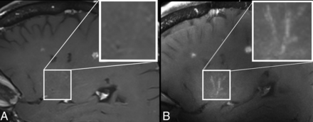 FIG 2.