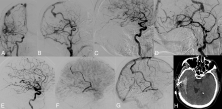 Fig 4.