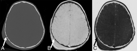 Fig 1.