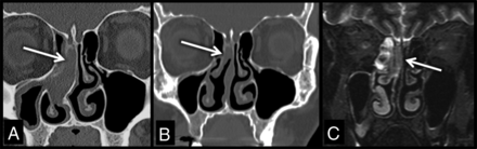 Fig 2.