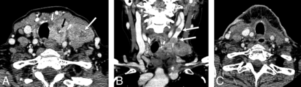 Fig 6.