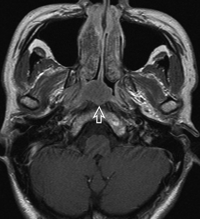 Fig 2.