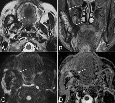 Fig 3.